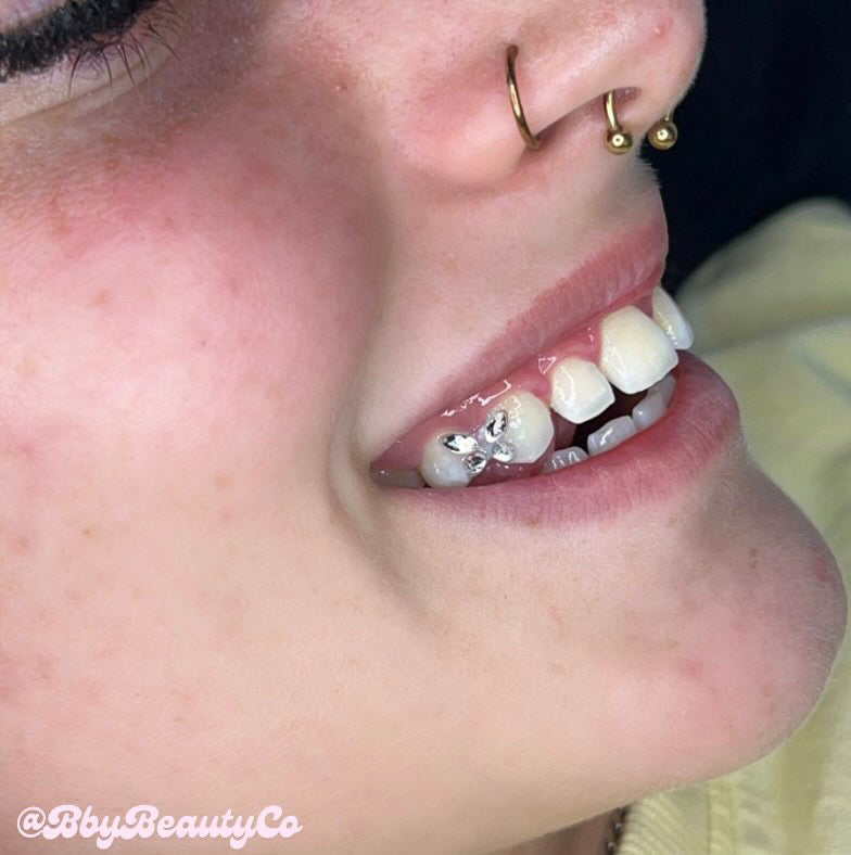 Rhinestone Tooth Gems - Butterfly