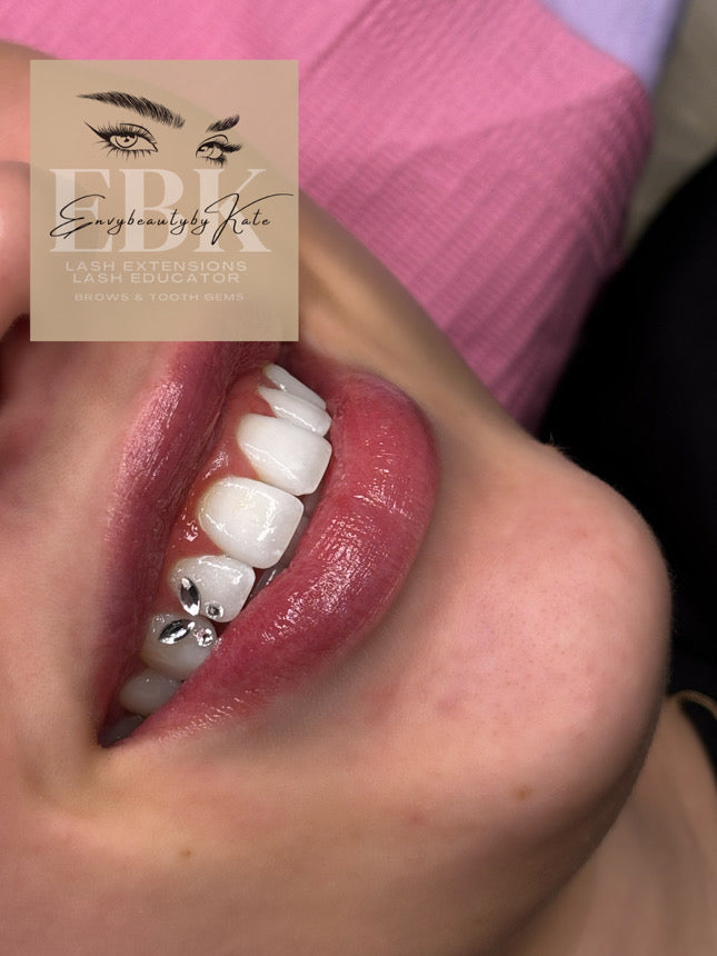 Rhinestone Tooth Gems - Butterfly