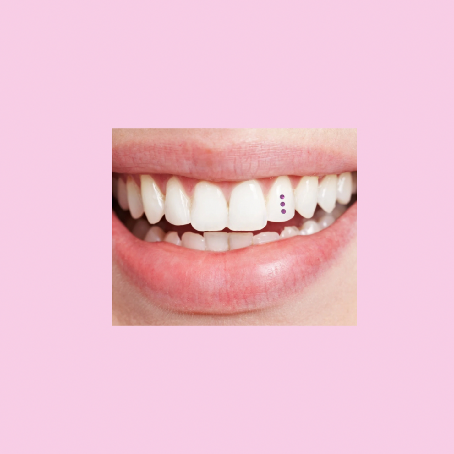 picture of tooth gem on tooth