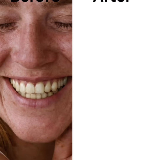 cosmetic whitening video