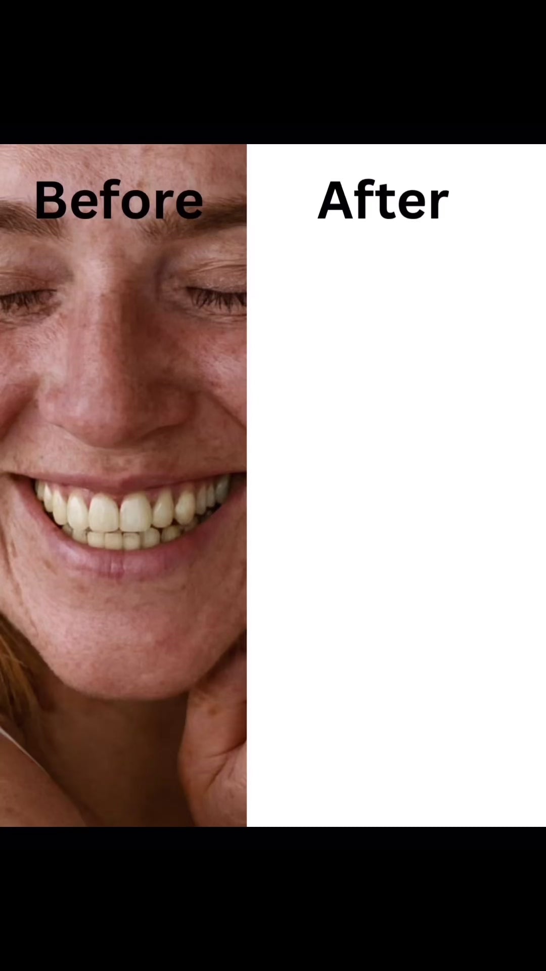 cosmetic whitening video